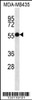 Western blot analysis in MDA-MB435 cell line lysates (35ug/lane) .