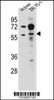 Western blot analysis in mouse liver tissue and ZR-75-1 cell line lysates (35ug/lane) .