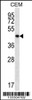 Western blot analysis in CEM cell line lysates (35ug/lane) .