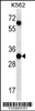 Western blot analysis in K562 cell line lysates (35ug/lane) .