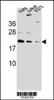 Western blot analysis in A375, Hela, Jurkat cell line lysates (35ug/lane) .This demonstrates the Adetected the ARL6IP6 protein (arrow) .