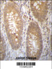 DHRS7B Antibody immunohistochemistry analysis in formalin fixed and paraffin embedded human colon tissue followed by peroxidase conjugation of the secondary antibody and DAB staining.