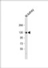 Western Blot at 1:2000 dilution + mouse kidney lysate Lysates/proteins at 20 ug per lane.