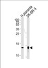 Western blot analysis of lysates from human placenta tissue lysate, SK-BR-3 cell line (from left to right) , using Trx2 Antibody (I151) at 1:1000 at each lane.