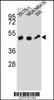 Western blot analysis in ZR-75-1, MDA-MB435, 293 cell line lysates (35ug/lane) .