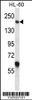 Western blot analysis in HL-60 cell line lysates (35ug/lane) .