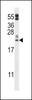 Western blot analysis in A2058 cell line lysates (35ug/lane) .