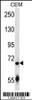 Western blot analysis in CEM cell line lysates (35ug/lane) .