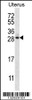 Western blot analysis in human normal Uterus tissue lysates (35ug/lane) .