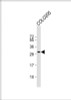 Western Blot at 1:1000 dilution + COLO205 whole cell lysate Lysates/proteins at 20 ug per lane.