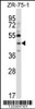 Western blot analysis in ZR-75-1 cell line lysates (35ug/lane) .This demonstdetected the NEUROD6 protein (arrow) .