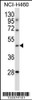 Western blot analysis in NCI-H460 cell line lysates (35ug/lane) .This demonstdetected the TLE6 protein (arrow) .