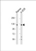 Western Blot at 1:1000 dilution Lane 1: Ramos whole cell lysate Lane 2: U-2OS whole cell lysate Lysates/proteins at 20 ug per lane.