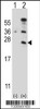 Western blot analysis of CD3E using rabbit polyclonal CD3E Antibody using 293 cell lysates (2 ug/lane) either nontransfected (Lane 1) or transiently transfected (Lane 2) with the CD3E gene.