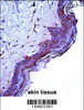 CD1A Antibody immunohistochemistry analysis in formalin fixed and paraffin embedded human skin tissue followed by peroxidase conjugation of the secondary antibody and DAB staining.