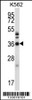 Western blot analysis in K562 cell line lysates (35ug/lane) .