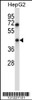 Western blot analysis in HepG2 cell line lysates (35ug/lane) .