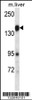 Western blot analysis in mouse liver tissue lysates (35ug/lane) .