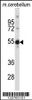 Western blot analysis in mouse cerebellum tissue lysates (35ug/lane) .