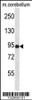 Western blot analysis in mouse cerebellum tissue lysates (35ug/lane) .