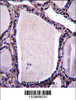 NSMAF Antibody immunohistochemistry analysis in formalin fixed and paraffin embedded human thyroid tissue followed by peroxidase conjugation of the secondary antibody and DAB staining.