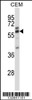 Western blot analysis in CEM cell line lysates (35ug/lane) .