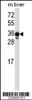 Western blot analysis in mouse liver tissue lysates (35ug/lane) .