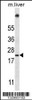 Western blot analysis in mouse liver tissue lysates (35ug/lane) .