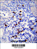 TNN Antibody immunohistochemistry analysis in formalin fixed and paraffin embedded human uterus tissue followed by peroxidase conjugation of the secondary antibody and DAB staining.