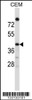 Western blot analysis in CEM cell line lysates (35ug/lane) .