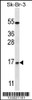 Western blot analysis in SK-BR-3 cell line lysates (35ug/lane) .