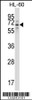 Western blot analysis in HL-60 cell line lysates (35ug/lane) .