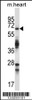 Western blot analysis in mouse heart tissue lysates (35ug/lane) .