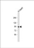 Western Blot at 1:1000 dilution + human heart lysate Lysates/proteins at 20 ug per lane.