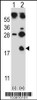 Western blot analysis of HBG1 using rabbit polyclonal HBG1 Antibody using 293 cell lysates (2 ug/lane) either nontransfected (Lane 1) or transiently transfected (Lane 2) with the HBG1 gene.