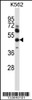 Western blot analysis in K562 cell line lysates (35ug/lane) .