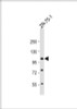 Western Blot at 1:1000 dilution + ZR-75-1 whole cell lysate Lysates/proteins at 20 ug per lane.