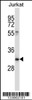 Western blot analysis in Jurkat cell line lysates (35ug/lane) .