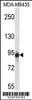 Western blot analysis in MDA-MB435 cell line lysates (35ug/lane) .