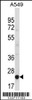 Western blot analysis in A549 cell line lysates (35ug/lane) .