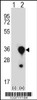 Western blot analysis of MBL2 using rabbit polyclonal MBL2 Antibody using 293 cell lysates (2 ug/lane) either nontransfected (Lane 1) or transiently transfected (Lane 2) with the MBL2 gene.