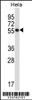 Western blot analysis in Hela cell line lysates (35ug/lane) .
