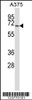 Western blot analysis in A375 cell line lysates (35ug/lane) .