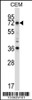 Western blot analysis in CEM cell line lysates (35ug/lane) .