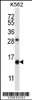 Western blot analysis in K562 cell line lysates (35ug/lane) .