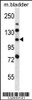 Western blot analysis in mouse bladder tissue lysates (35ug/lane) .