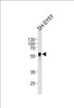 Western blot analysis of lysate from SH-SY5Y cell line, using ABHD3 Antibody at 1:1000 at each lane.