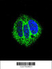 Confocal immunofluorescent analysis of RARA Antibody with MCF-7 cell followed by Alexa Fluor 488-conjugated goat anti-rabbit lgG (green) . DAPI was used to stain the cell nuclear (blue) .