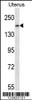 Western blot analysis in human normal Uterus tissue lysates (35ug/lane) .