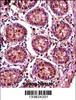 SMC1B Antibody immunohistochemistry analysis in formalin fixed and paraffin embedded human colon tissue followed by peroxidase conjugation of the secondary antibody and DAB staining.